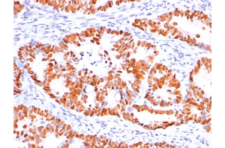 Immunohistochemistry - Anti-p53 Antibody [BP53-12] (A250177) - Antibodies.com