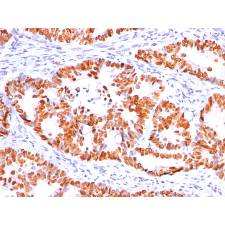 Immunohistochemistry - Anti-p53 Antibody [BP53-12] (A250177) - Antibodies.com