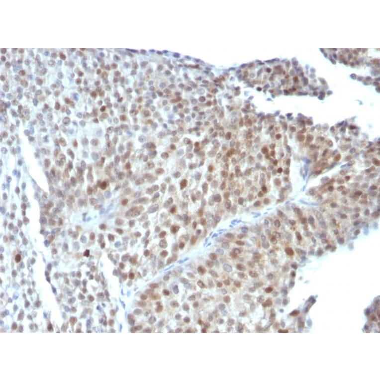 Immunohistochemistry - Anti-p53 Antibody [SPM589] (A250178) - Antibodies.com
