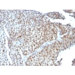 Immunohistochemistry - Anti-p53 Antibody [SPM589] (A250178) - Antibodies.com