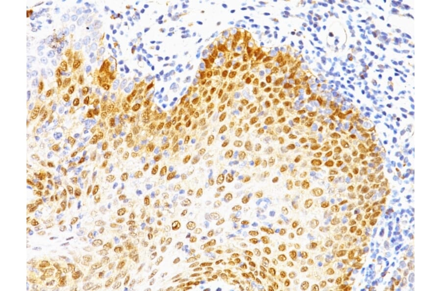 Immunohistochemistry - Anti-p53 Antibody [BP53-12 + DO-7] (A250181) - Antibodies.com