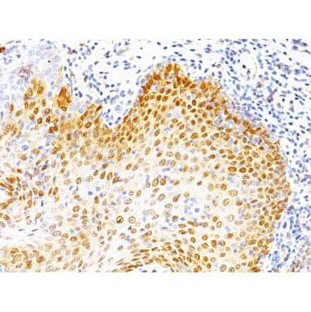 Immunohistochemistry - Anti-p53 Antibody [BP53-12 + DO-7] (A250181) - Antibodies.com