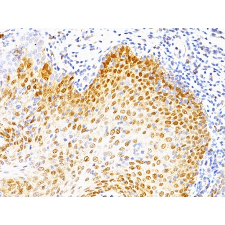 Immunohistochemistry - Anti-p53 Antibody [BP53-12 + DO-7] (A250181) - Antibodies.com