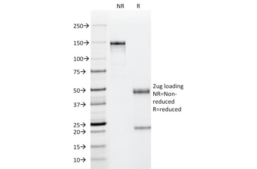 SDS-PAGE - Anti-p53 Antibody [PAb122] (A250183) - Antibodies.com