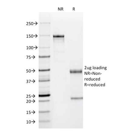 SDS-PAGE - Anti-p53 Antibody [PAb122] (A250183) - Antibodies.com