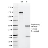 SDS-PAGE - Anti-p53 Antibody [PAb122] (A250183) - Antibodies.com