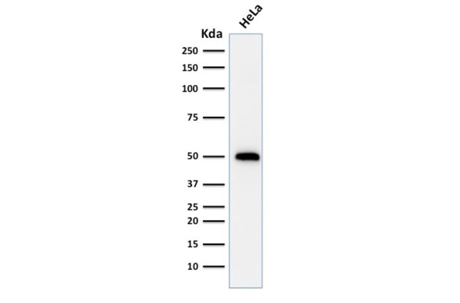 Western Blot - Anti-p53 Antibody [TRP/816] (A250184) - Antibodies.com