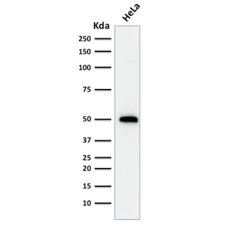 Western Blot - Anti-p53 Antibody [TRP/816] (A250184) - Antibodies.com