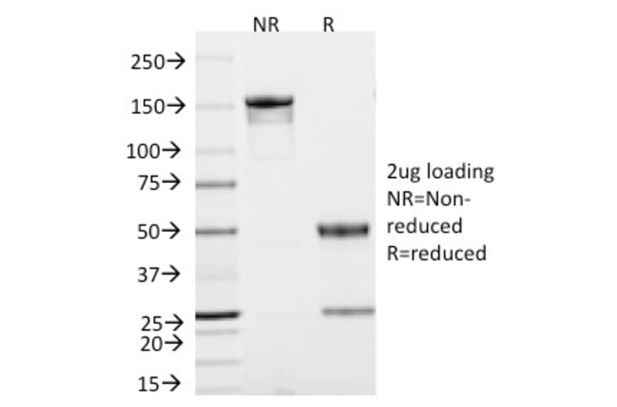 SDS-PAGE - Anti-p53 Antibody [TRP/816] (A250184) - Antibodies.com