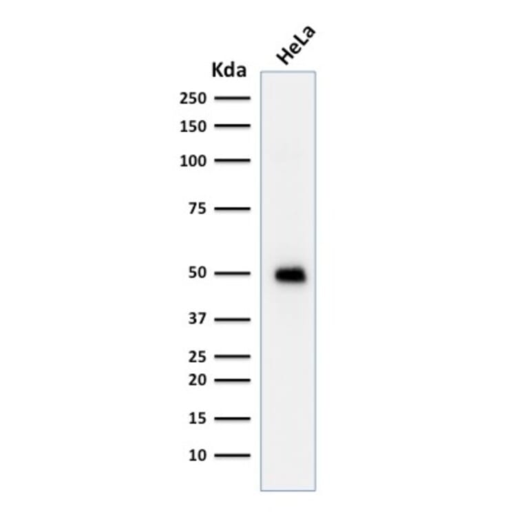 Western Blot - Anti-p53 Antibody [TRP/817] (A250185) - Antibodies.com