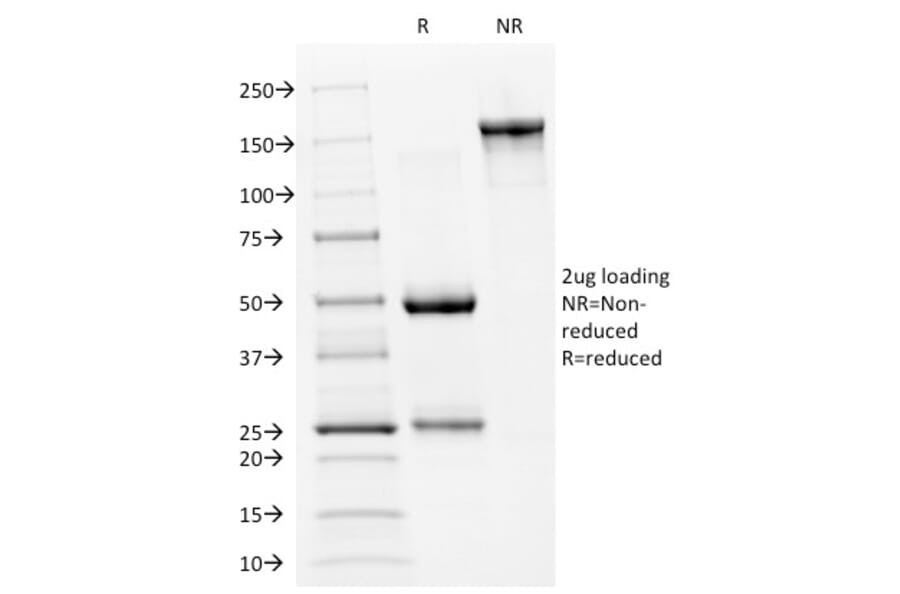SDS-PAGE - Anti-p53 Antibody [PAb240] (A250186) - Antibodies.com