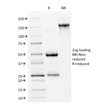 SDS-PAGE - Anti-p53 Antibody [PAb240] (A250186) - Antibodies.com