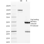 SDS-PAGE - Anti-p53 Antibody [DO-1] (A250188) - Antibodies.com
