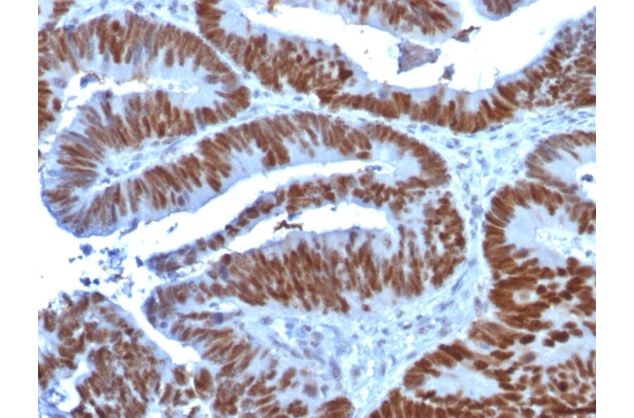 Immunohistochemistry - Anti-p53 Antibody [TP53/1739] (A250189) - Antibodies.com