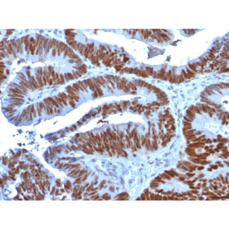 Immunohistochemistry - Anti-p53 Antibody [TP53/1739] (A250189) - Antibodies.com