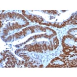 Immunohistochemistry - Anti-p53 Antibody [TP53/1739] (A250189) - Antibodies.com
