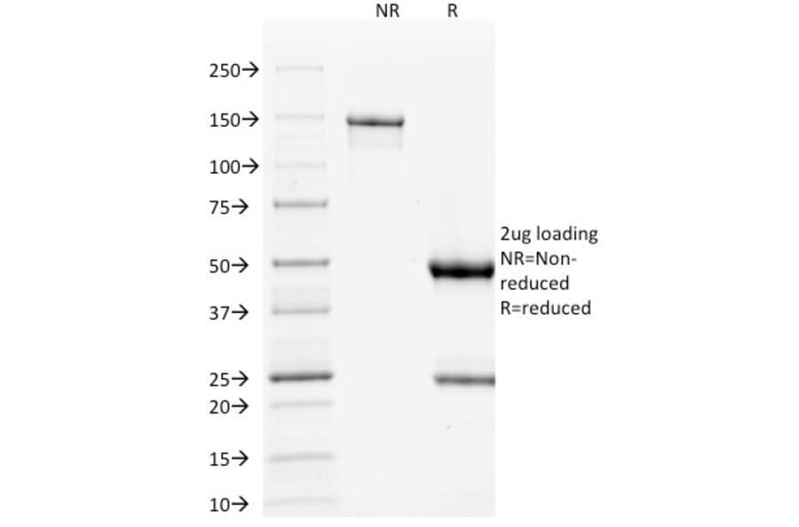 SDS-PAGE - Anti-p53 Antibody [TP53/1739] (A250189) - Antibodies.com