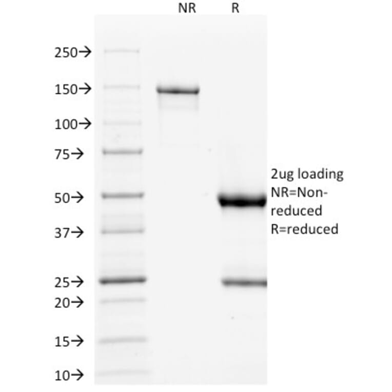 SDS-PAGE - Anti-p53 Antibody [TP53/1739] (A250189) - Antibodies.com