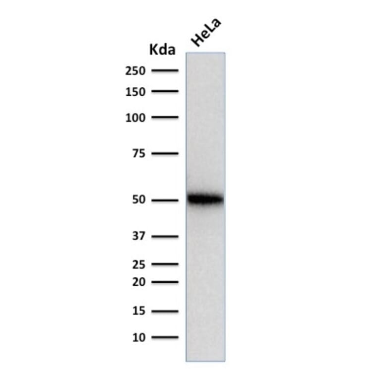 Western Blot - Anti-p53 Antibody [SPM514] (A253360) - Antibodies.com