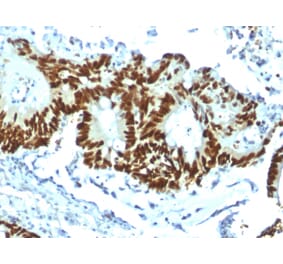 Immunohistochemistry - Anti-p53 Antibody [TP53/1799R] (A250191) - Antibodies.com