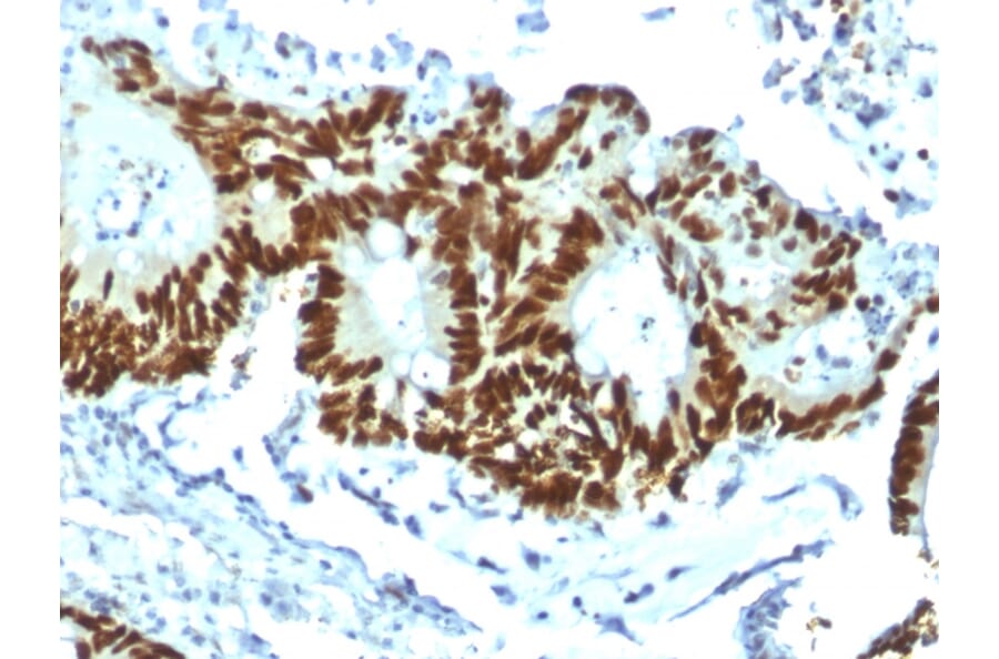 Immunohistochemistry - Anti-p53 Antibody [TP53/1799R] (A250191) - Antibodies.com