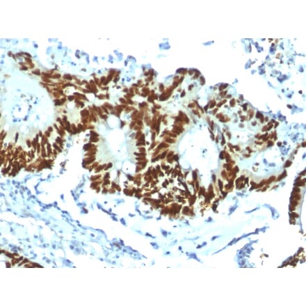 Immunohistochemistry - Anti-p53 Antibody [TP53/1799R] (A250191) - Antibodies.com