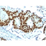 Immunohistochemistry - Anti-p53 Antibody [TP53/1799R] (A250191) - Antibodies.com