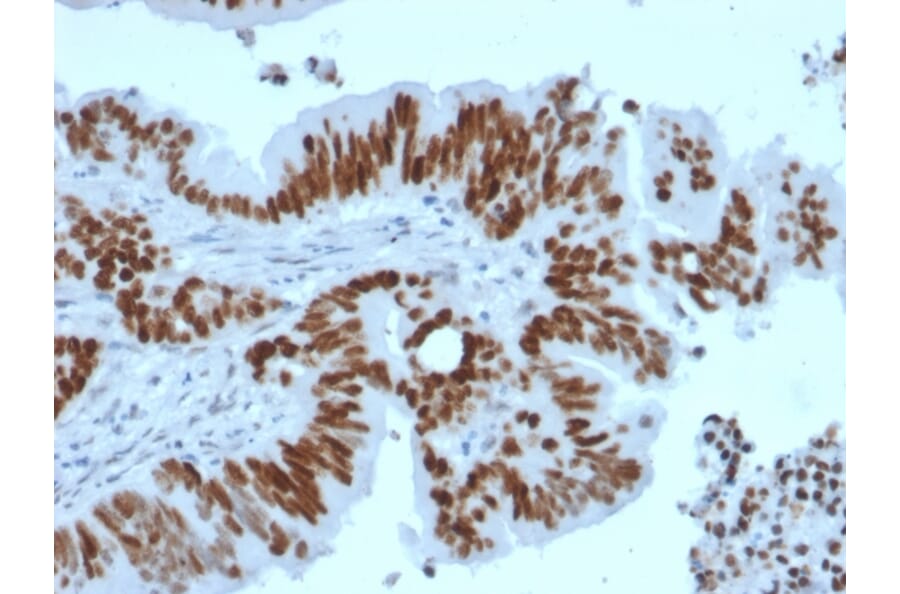 Immunohistochemistry - Anti-p53 Antibody [TP53/2092R] (A250192) - Antibodies.com