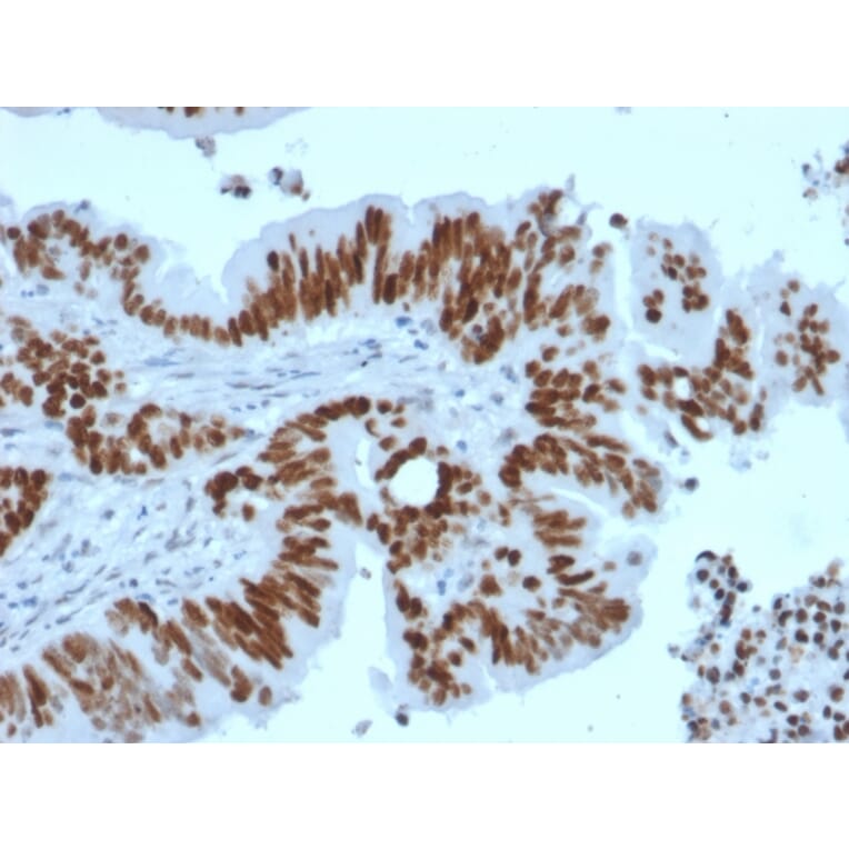 Immunohistochemistry - Anti-p53 Antibody [TP53/2092R] (A250192) - Antibodies.com