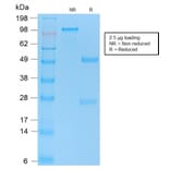 SDS-PAGE - Anti-p53 Antibody [TP53/2092R] (A250192) - Antibodies.com