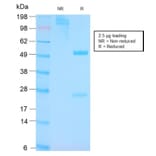 SDS-PAGE - Anti-p53 Antibody [TP53/3156R] (A250192) - Antibodies.com