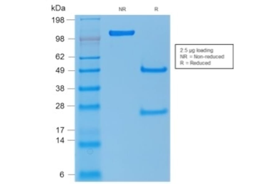SDS-PAGE - Anti-p53 Antibody (A250194) - Antibodies.com