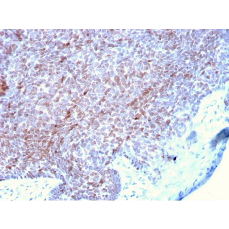 Immunohistochemistry - Anti-p73 Antibody [P73/2531] (A250194) - Antibodies.com
