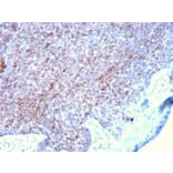 Immunohistochemistry - Anti-p73 Antibody [P73/2531] (A250194) - Antibodies.com