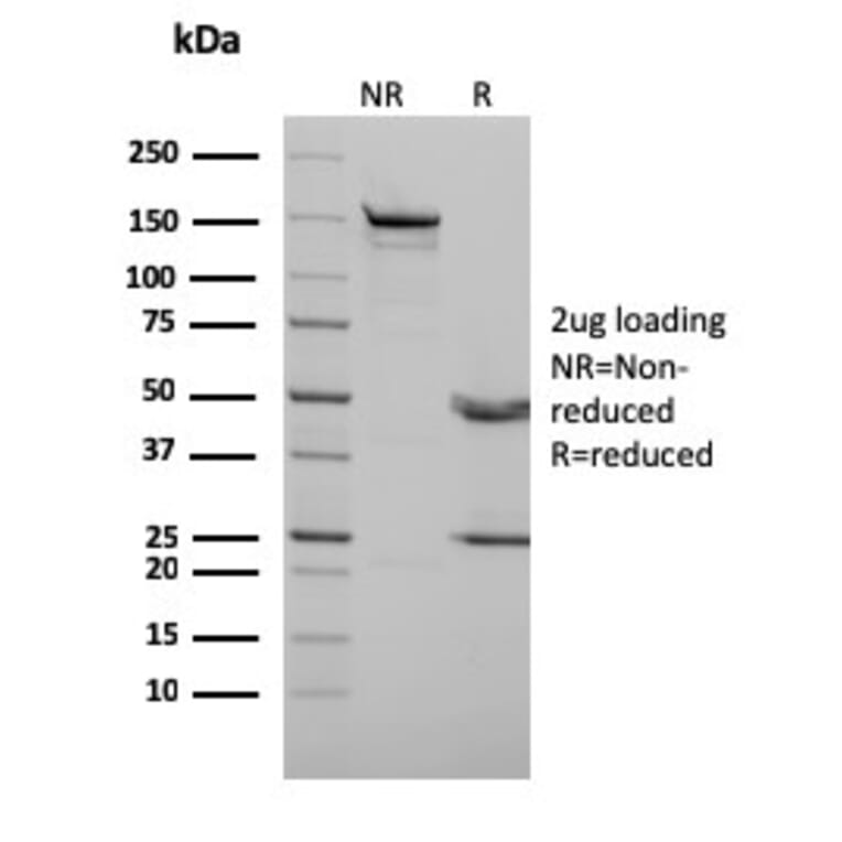 SDS-PAGE - Anti-p73 Antibody [P73/2531] (A250195) - Antibodies.com