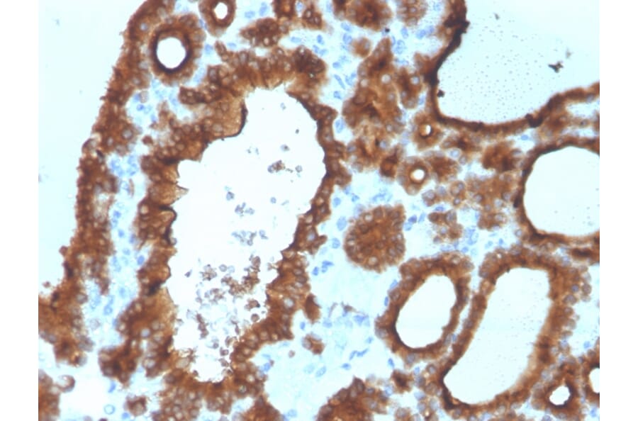 Immunohistochemistry - Anti-Thyroid Peroxidase Antibody [TPO/3700] (A250196) - Antibodies.com
