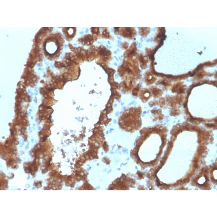 Immunohistochemistry - Anti-Thyroid Peroxidase Antibody [TPO/3700] (A250196) - Antibodies.com