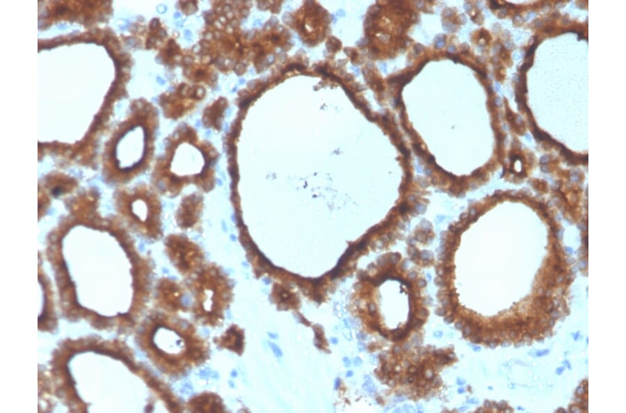 Immunohistochemistry - Anti-Thyroid Peroxidase Antibody [TPO/3700] (A250196) - Antibodies.com