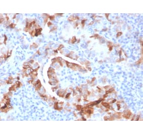 Immunohistochemistry - Anti-Thyroid Peroxidase Antibody [TPO/3701] (A250197) - Antibodies.com