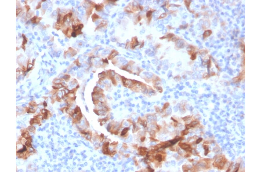 Immunohistochemistry - Anti-Thyroid Peroxidase Antibody [TPO/3701] (A250197) - Antibodies.com