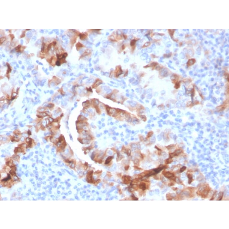 Immunohistochemistry - Anti-Thyroid Peroxidase Antibody [TPO/3701] (A250197) - Antibodies.com