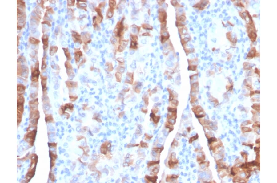 Immunohistochemistry - Anti-Thyroid Peroxidase Antibody [TPO/3701] (A250197) - Antibodies.com
