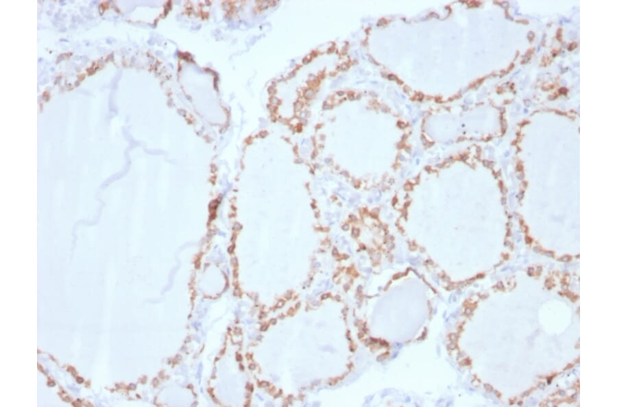 Immunohistochemistry - Anti-Thyroid Peroxidase Antibody [TPO/3702] (A250198) - Antibodies.com