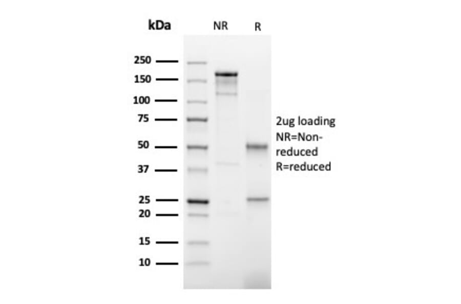 SDS-PAGE - Anti-Thyroid Peroxidase Antibody [TPO/3702] (A250198) - Antibodies.com