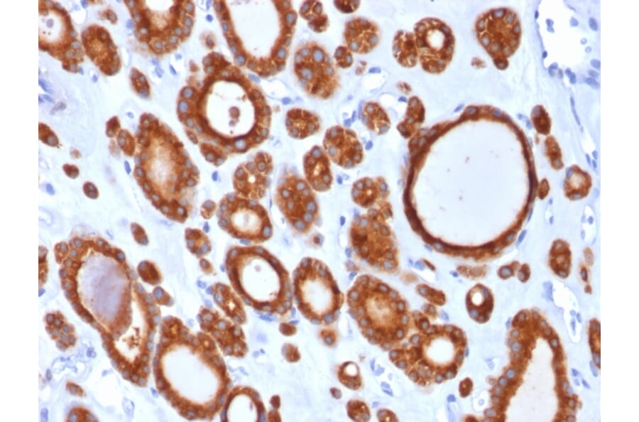 Immunohistochemistry - Anti-Thyroid Peroxidase Antibody [TPO/1921] (A250198) - Antibodies.com