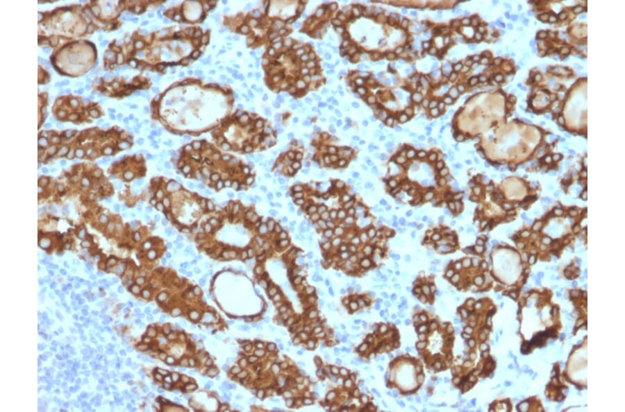 Immunohistochemistry - Anti-Thyroid Peroxidase Antibody [TPO/1922] (A250200) - Antibodies.com