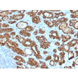 Immunohistochemistry - Anti-Thyroid Peroxidase Antibody [TPO/1922] (A250200) - Antibodies.com