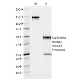 SDS-PAGE - Anti-Thyroid Peroxidase Antibody [TPO/1922] (A250200) - Antibodies.com