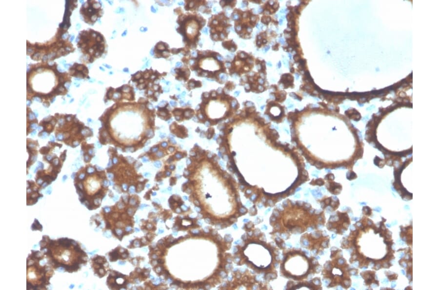 Immunohistochemistry - Anti-Thyroid Peroxidase Antibody [TPO/3694] (A250201) - Antibodies.com