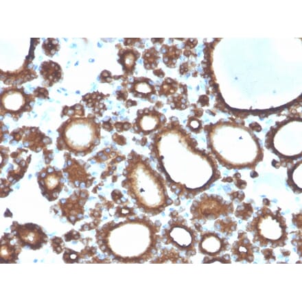 Immunohistochemistry - Anti-Thyroid Peroxidase Antibody [TPO/3694] (A250201) - Antibodies.com